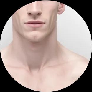 Fitzpatrick skin type I